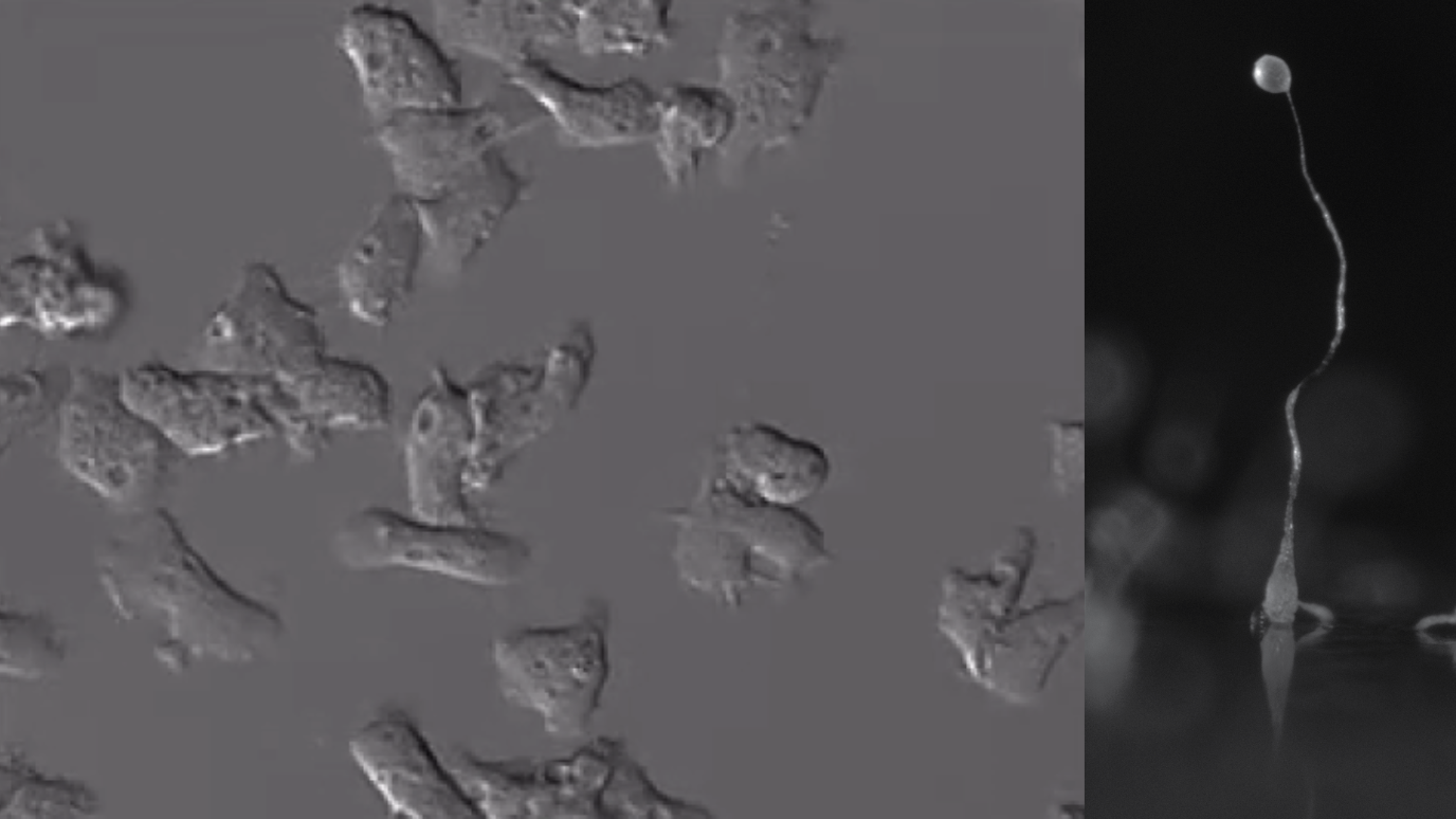 Dictyostelium cells under microscope and at macro level 